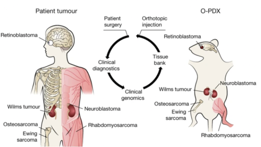 Tumour diagram